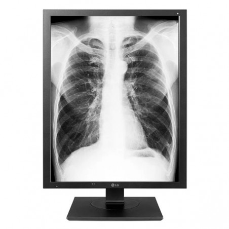 LG MONITOR DIAGNOSTICO IPS 22" (21.3) 3MP QXGA DVI DP HAS 21